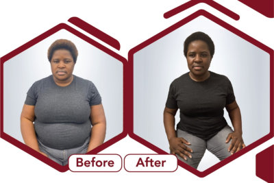 before and after