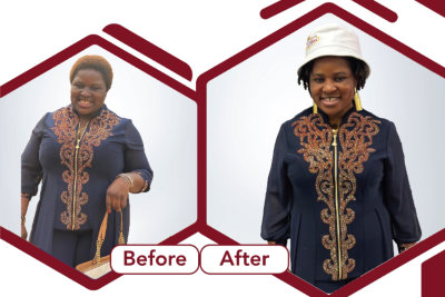 before and after